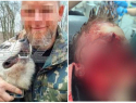 Тюрьма не грозит владельцу собак, разорвавшим лицо мальчику в Сочи