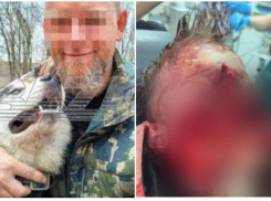 В суде Сочи вынесли приговор владельцу хаски, откусившим лицо 9-летнему мальчику