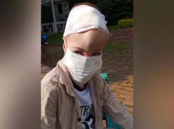 9-летнему мальчику, лицо которого съели собаки в Сочи, стало хуже