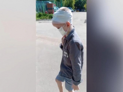 Стало известно о состоянии мальчика, лицо которого съели собаки в Сочи, после пластики носа
