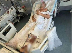 Два уголовных дело возбуждены после ранения российского туриста в Абхазии