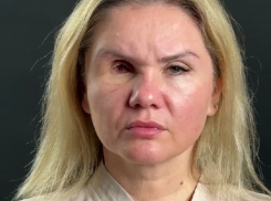  Жительница Сочи, лишившаяся глаза из-за бывшего парня, опубликовала ролик в поддержку принятия закона о домашнем насилии