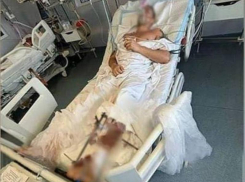 Голый торс стал причиной огнестрельного ранения туриста в Абхазии