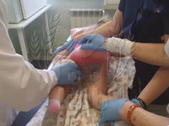 Термический ожог нанесли ребенку в детсаду Сочи