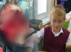 14-часовая операция прошла у 9-летнего мальчика, пострадавшего от нападения собак в Сочи