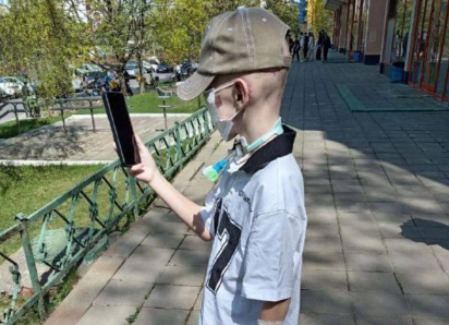 У 9-летнего мальчика, лицо которого съели собаки в Сочи, случился отек