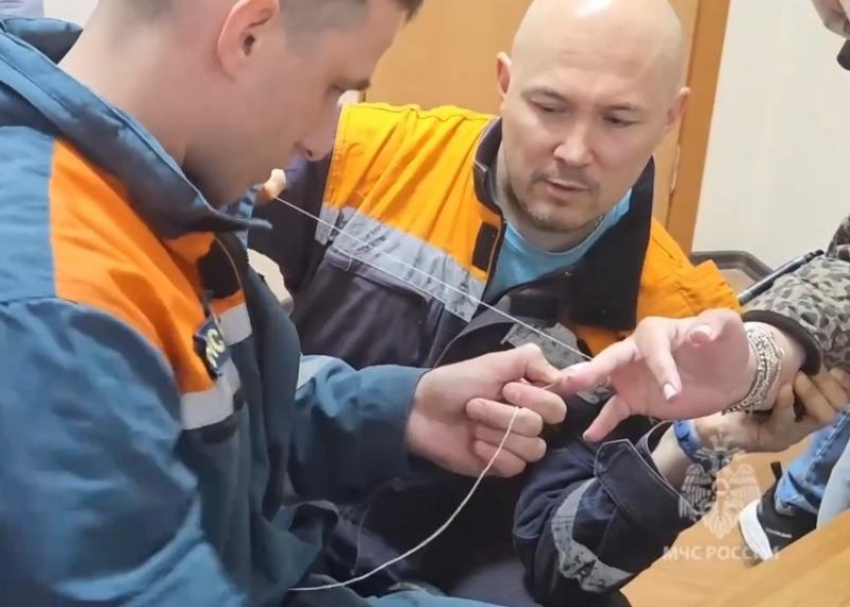 Жительница Сочи едва не лишилась пальца, пытаясь снять обручальное кольцо