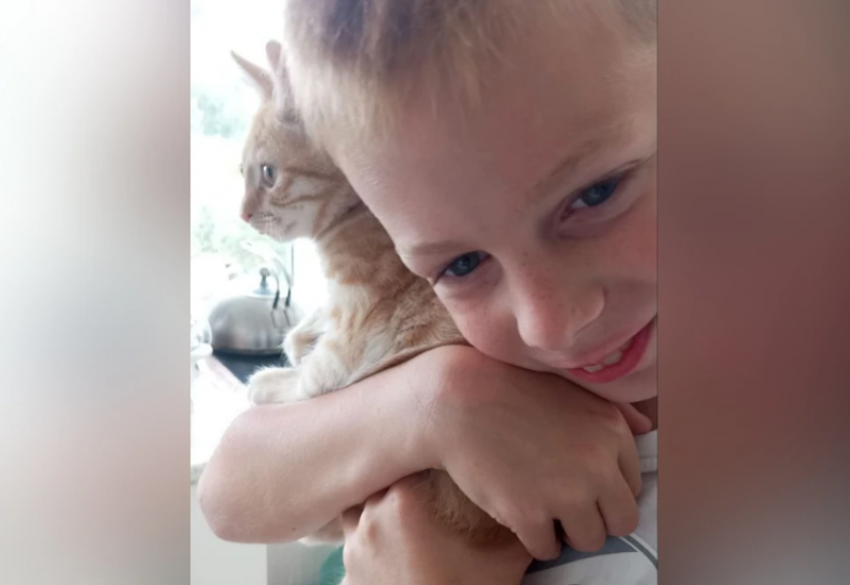 9-летний мальчик, лицо которого съели хаски в Сочи, получил инвалидность