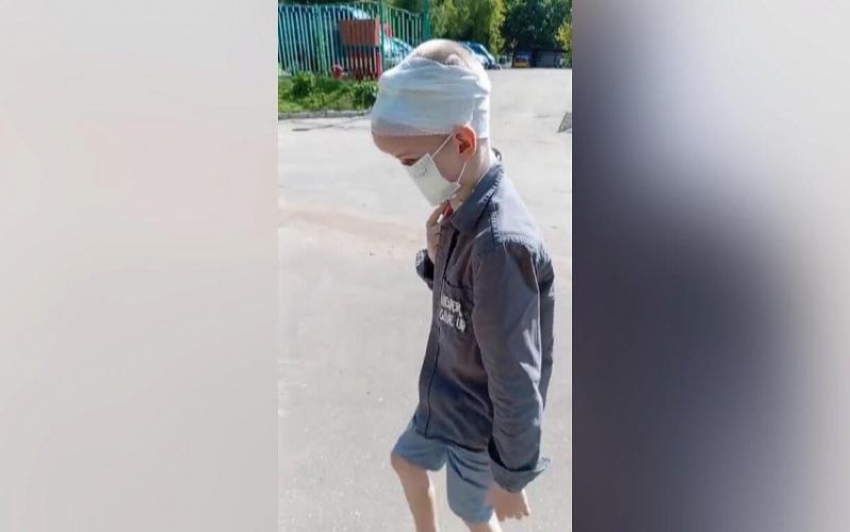 Стало известно о состоянии мальчика, лицо которого съели собаки в Сочи, после пластики носа