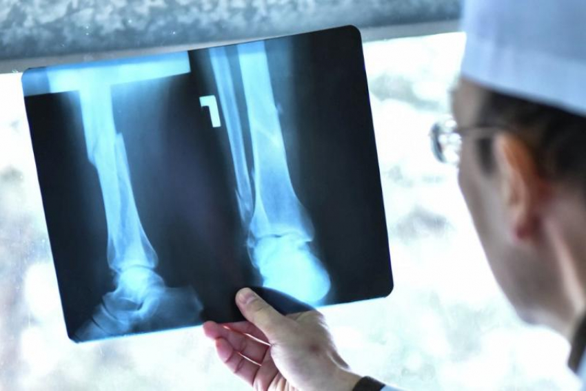 Призывник из Сочи пытался «откосить» от армии с помощью чужих рентгенснимков